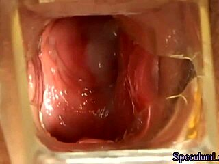 Speculum and baseball bat fetish action with a curvy babe